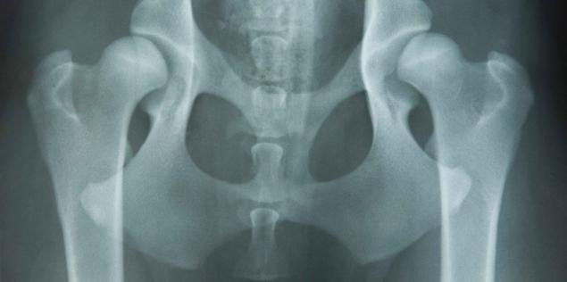 Foto: iStock HD røntgenbilde